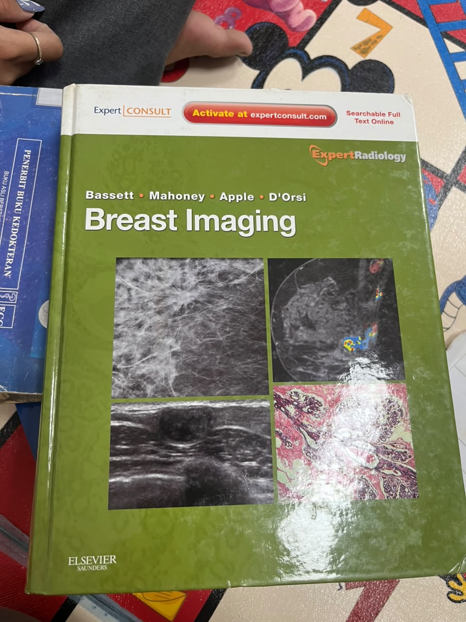 Breast Imaging
